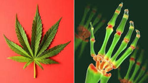 5 Best Cannabis Strains for Pain Relief from Arthritis (2020 Update)